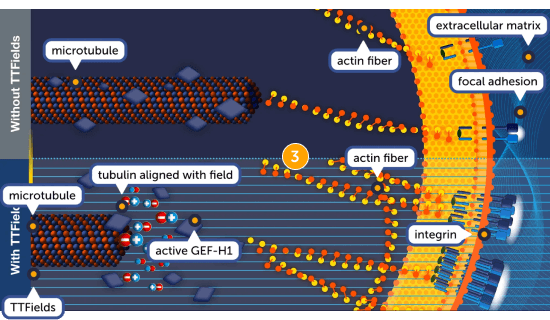 TTFields modifying actin fiber structure and extracellular matrix